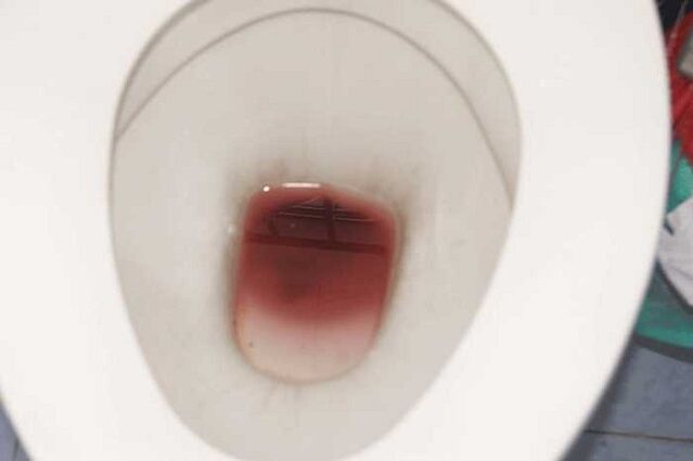 madeži pri moških, ko so navdušeni